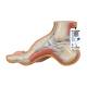3B Scientific M32 Hollow (Pes Cavus) Foot Model - Light Skin Tone