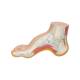3B Scientific M32 Hollow (Pes Cavus) Foot Model - Light Skin Tone