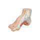 3B Scientific M32 Hollow (Pes Cavus) Foot Model - Light Skin Tone