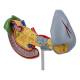 Nasco MG14742 Pancreas, Spleen, and Gallbladder with Pathologies Model - Right Side