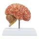 Nasco MG17228 Brain with Arteries Model - Angle 4