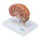 Nasco MG17228 Brain with Arteries Model - Angle 2