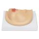 Nasco MG17229 Breast Cross-Section with Pathologies Model - Side View
