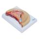 Nasco MG17229 Breast Cross-Section with Pathologies Model - Left Angle