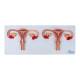 Nasco MG19471 Uterus with Fertilization Process Model - Angle 1