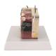 Nasco MG21066 Skin Section with Burn Model, 30x Enlarged - Right Side Angled View