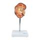 Nasco MG21415 Kidney Stone Model - Front View