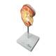 Nasco MG21415 Kidney Stone Model - Top Left Angle View