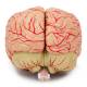 Nasco MG21716 Brain with Arteries Model, 2 Parts - Angle 3