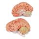 Nasco MG21716 Brain with Arteries Model, 2 Parts - Angle 4