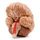 Nasco MG21717 Brain with Arteries Model, 9 Parts - Angle 4
