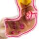 Nasco MG21850 Colon with Intestinal Pathologies Model - Angle 2 Close-up