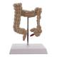 Nasco MG21850 Colon with Intestinal Pathologies Model - Back View