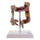 Nasco MG21850 Colon with Intestinal Pathologies Model - Front View