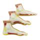 Nasco MG22042 Normal and Abnormal Foot Model, Set of 3, Left Side View