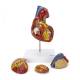 Nasco MG22271 Heart Model, 2x Enlarged, Disassembled