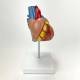 Nasco MG22274 Classic Heart with Ventricular Hypertrophy Model, Right Side View