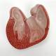 Nasco MG22274 Classic Heart with Ventricular Hypertrophy Model, Removable Section