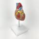 Nasco MG22274 Classic Heart with Ventricular Hypertrophy Model, Right Angle View