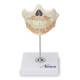 Nasco MG22595 Baby Teeth Model - Front View