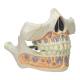 Nasco MG22595 Baby Teeth Model - Right Angle Clode-Up