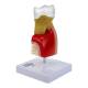 Nasco MG22727 Dental Disease Model, 10x Enlarged - Back View