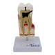 Nasco MG22727 Dental Disease Model, 10x Enlarged - Front View