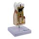 Nasco MG22727 Dental Disease Model, 10x Enlarged - Right Angle