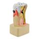 Nasco MG22728 Dental Disease Model, 4x Enlarged - Back View