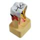 Nasco MG22728 Dental Disease Model, 4x Enlarged - Top View