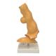 Nasco MG22729 Esophageal Disease Model, 5x Enlarged - Back View