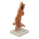 Nasco MG22729 Esophageal Disease Model, 5x Enlarged - Right Angle