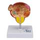 Nasco MG22730 Bladder and Prostate Diseases Model - Front View