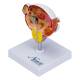Nasco MG22730 Bladder and Prostate Diseases Model - Left Angle