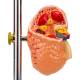 Nasco MG22747 Effects of Arterial Hypertension Pathology Model, 5-Part, Kidney Close-up View