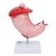 Nasco MG23162 Stomach with Gastric Ulcers Model - Back View