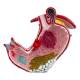 Nasco MG23162 Stomach with Gastric Ulcers Model - Close-up