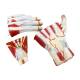 Nasco MG23166 Hand Model, 2x Enlarged, 3 Parts, Back View of Disassembled Components