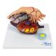 Nasco MG23170 Ovary Model, 5x Enlarged, 2 Parts - Front View
