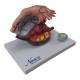 Nasco MG23170 Ovary Model, 5x Enlarged, 2 Parts - Right Angle