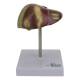 Nasco MG23415 Liver Section with Pathology Model, 2 Parts - Front View