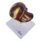 Nasco MG23415 Liver Section with Pathology Model, 2 Parts - Top View