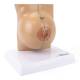 Nasco MG29240 Breast Model, Non-Lactating - Right Angle