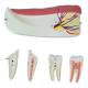 Nasco MG29512 Half Lower Jaw Model, 3x Enlarged, 6 Parts - Disassembled