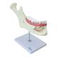 Nasco MG29512 Half Lower Jaw Model, 3x Enlarged, 6 Parts - Front View