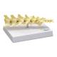 Nasco MG29736 Canine Lumbar Vertebral Model - Angle 1