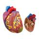 Nasco MG29749 Arterial Hypertension Model, Heart