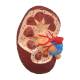 Nasco MG29749 Arterial Hypertension Model, Kidney