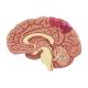 Nasco MG29749 Arterial Hypertension Model, Brain