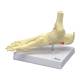 Nasco MG29758 Foot and Ankle with Plantar Fasciitis Model, Left Angle View
